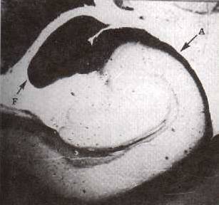 f05.jpg (12135 bytes)