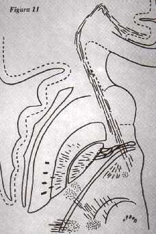 f11.jpg (15383 bytes)