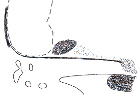 wpe27.gif (5207 bytes)