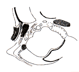 wpe2B.gif (6390 bytes)
