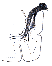 wpe29.gif (5285 bytes)