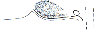wpe2F.gif (4295 bytes)
