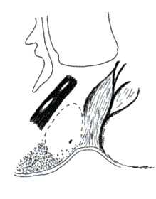 wpe16.gif (7268 bytes)