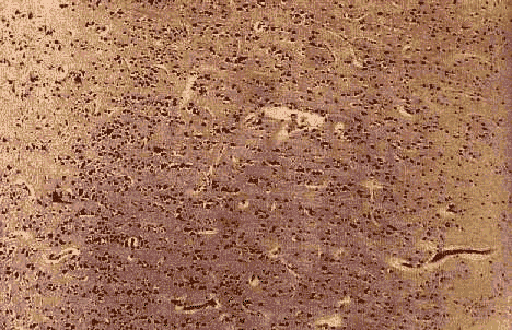 wpe5C.gif (72828 bytes)