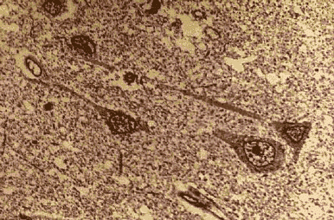 wpe5D.gif (72915 bytes)