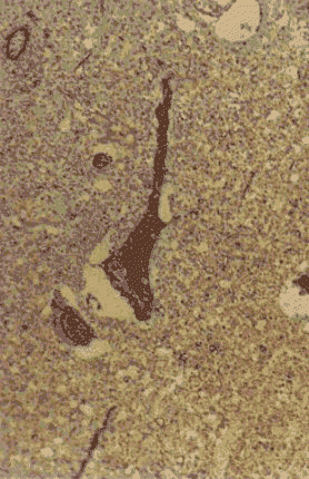 wpe5F.gif (56470 bytes)