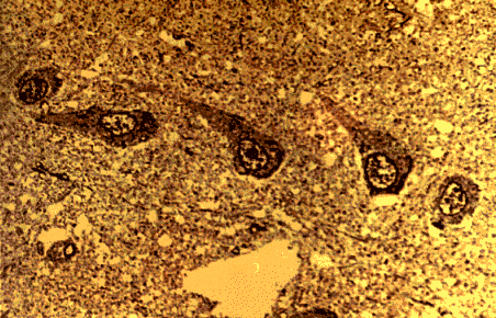 wpe2.gif (60831 bytes)